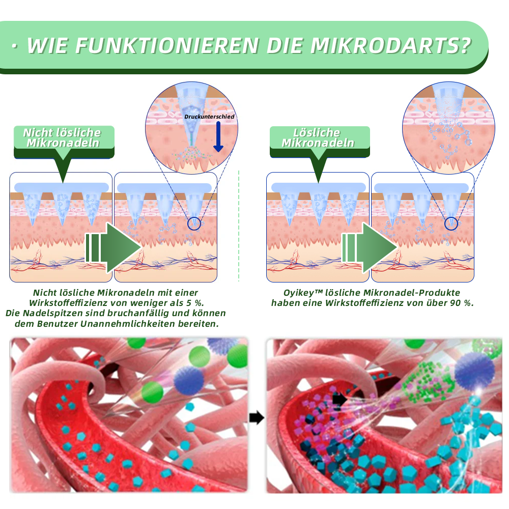 👨⚕️𝐋𝐞𝐫𝐜𝐞𝐚®SMGT-GLP-1 Nano-Mikronadel-Pflaster(Schmerzfrei, lang anhaltend, gegen Diabetes, Fettleibigkeit und Herz-Kreislauf-Erkrankungen)
