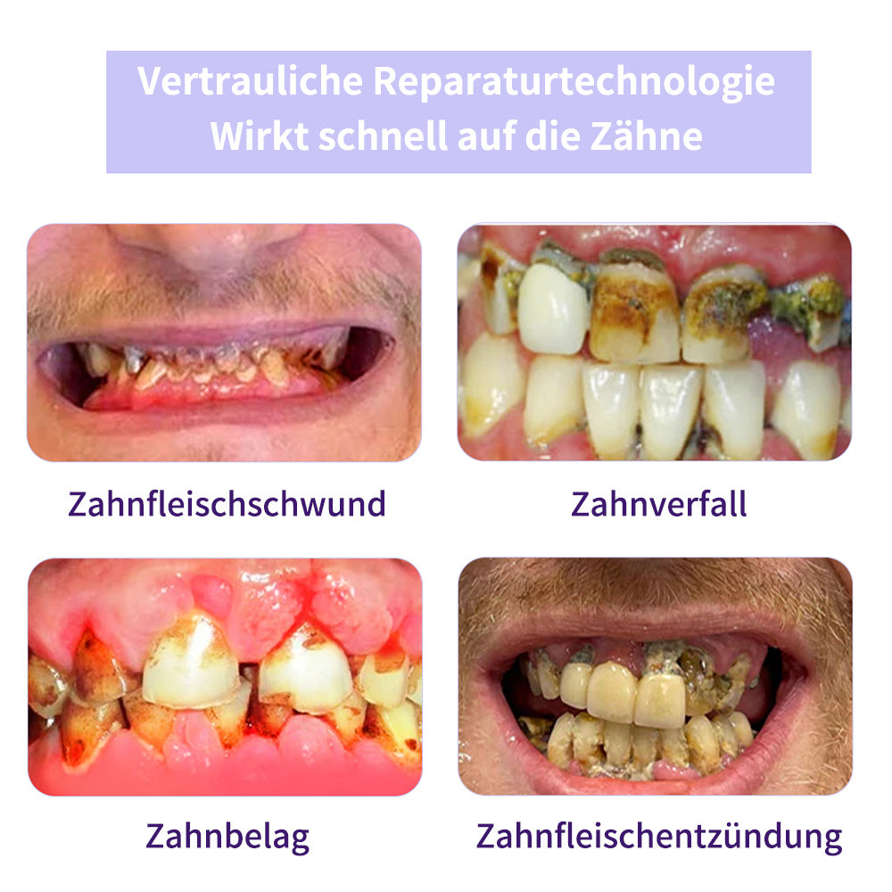 Zahnreparatur-Mineralpuderđ§CvreozÂŽ(Empfohlen von der EAD)Zusätzliche 30 % Rabatt