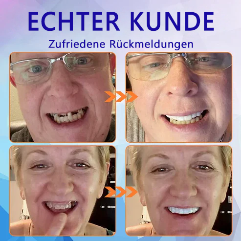𝐇𝐄𝐀𝐓𝐖𝐎𝐋𝐅®👨⚕️Fortgeschrittenes maßgeschneidertes Vollprothesenset 👨⚕️zertifiziert und entwickelt in Zusammenarbeit mit der Deutschen Gesellschaft für Zahn-Mund- und Kieferheilkunde (DGZMK)