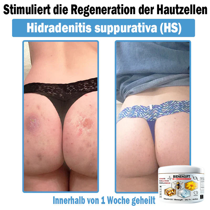 Verbesserung innerhalb von 7 Tagenโฐ๐ฟ๐ค๐ง๐ข๐ค๐ง๐ค๐ฃ๐โข ๐ต๐๐ช๐ก๐ฉ๐๐จ๐ฎ๐ข๐ฅ๐ฉ๐ค๐ข ๐ฝ๐๐๐ฃ๐๐ฃ๐๐๐๐ฉ ๐ฝ๐๐ง๐ช๐๐๐๐ช๐ฃ๐๐จ๐๐ง๐๐ข๐(๐จโโ๐๐๐ ๐๐ฆ๐ฉ๐๐จ๐ก๐ฅ๐๐ง) (๐๐ง๐ญ๐๐๐ซ๐ง๐ญ ๐๐ค๐ง๐, ๐๐๐ซ๐ณ๐๐ง, ๐๐จ๐ฌ๐๐๐๐, ๐๐ฌ๐จ๐ซ๐ข๐๐ฌ๐ข๐ฌ, ๐๐ฅ๐ญ๐๐ซ๐ฌ๐๐ฅ๐๐๐ค๐๐ง, ๐๐ค๐ณ๐๐ฆ๐ ๐ฎ๐ง๐ ๐ ๐ฅรค๐ญ๐ญ๐๐ญ ๐๐๐ก๐ง๐ฎ๐ง๐ ๐ฌ๐ฌ๐ญ๐ซ๐๐ข๐๐๐ง)