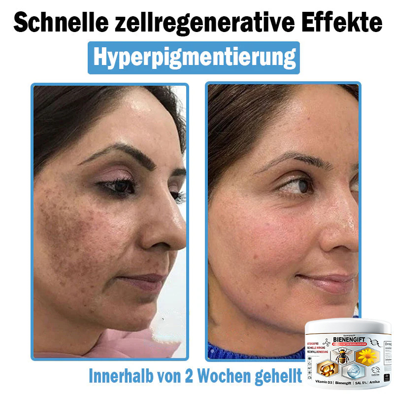 Verbesserung innerhalb von 7 Tagenโฐ๐ฟ๐ค๐ง๐ข๐ค๐ง๐ค๐ฃ๐โข ๐ต๐๐ช๐ก๐ฉ๐๐จ๐ฎ๐ข๐ฅ๐ฉ๐ค๐ข ๐ฝ๐๐๐ฃ๐๐ฃ๐๐๐๐ฉ ๐ฝ๐๐ง๐ช๐๐๐๐ช๐ฃ๐๐จ๐๐ง๐๐ข๐(๐จโโ๐๐๐ ๐๐ฆ๐ฉ๐๐จ๐ก๐ฅ๐๐ง) (๐๐ง๐ญ๐๐๐ซ๐ง๐ญ ๐๐ค๐ง๐, ๐๐๐ซ๐ณ๐๐ง, ๐๐จ๐ฌ๐๐๐๐, ๐๐ฌ๐จ๐ซ๐ข๐๐ฌ๐ข๐ฌ, ๐๐ฅ๐ญ๐๐ซ๐ฌ๐๐ฅ๐๐๐ค๐๐ง, ๐๐ค๐ณ๐๐ฆ๐ ๐ฎ๐ง๐ ๐ ๐ฅรค๐ญ๐ญ๐๐ญ ๐๐๐ก๐ง๐ฎ๐ง๐ ๐ฌ๐ฌ๐ญ๐ซ๐๐ข๐๐๐ง)