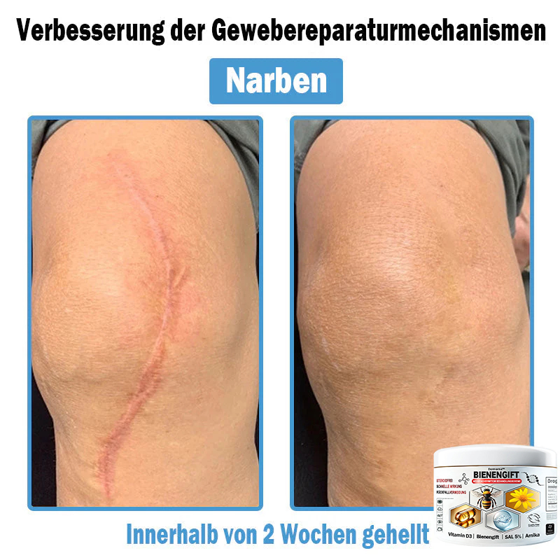 Verbesserung innerhalb von 7 Tagenโฐ๐ฟ๐ค๐ง๐ข๐ค๐ง๐ค๐ฃ๐โข ๐ต๐๐ช๐ก๐ฉ๐๐จ๐ฎ๐ข๐ฅ๐ฉ๐ค๐ข ๐ฝ๐๐๐ฃ๐๐ฃ๐๐๐๐ฉ ๐ฝ๐๐ง๐ช๐๐๐๐ช๐ฃ๐๐จ๐๐ง๐๐ข๐(๐จโโ๐๐๐ ๐๐ฆ๐ฉ๐๐จ๐ก๐ฅ๐๐ง) (๐๐ง๐ญ๐๐๐ซ๐ง๐ญ ๐๐ค๐ง๐, ๐๐๐ซ๐ณ๐๐ง, ๐๐จ๐ฌ๐๐๐๐, ๐๐ฌ๐จ๐ซ๐ข๐๐ฌ๐ข๐ฌ, ๐๐ฅ๐ญ๐๐ซ๐ฌ๐๐ฅ๐๐๐ค๐๐ง, ๐๐ค๐ณ๐๐ฆ๐ ๐ฎ๐ง๐ ๐ ๐ฅรค๐ญ๐ญ๐๐ญ ๐๐๐ก๐ง๐ฎ๐ง๐ ๐ฌ๐ฌ๐ญ๐ซ๐๐ข๐๐๐ง)
