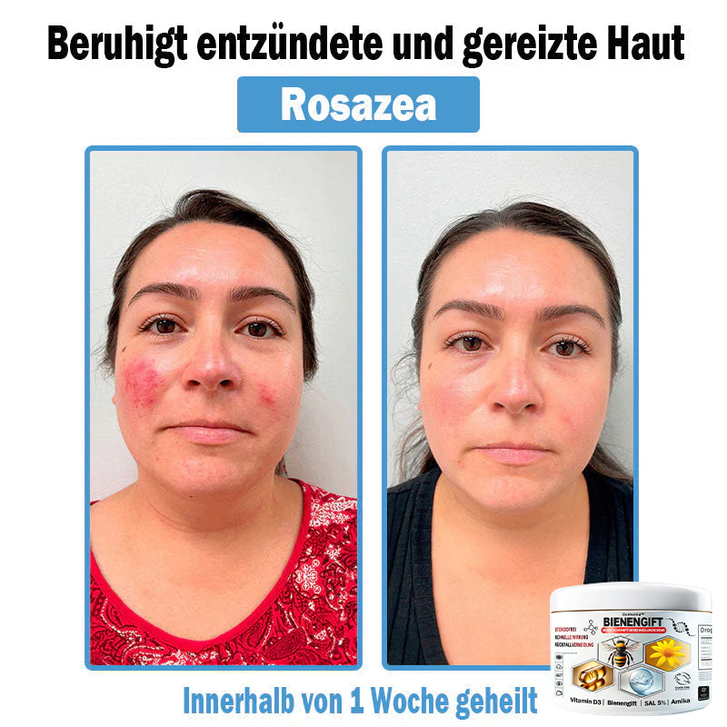 Verbesserung innerhalb von 7 Tagenโฐ๐ฟ๐ค๐ง๐ข๐ค๐ง๐ค๐ฃ๐โข ๐ต๐๐ช๐ก๐ฉ๐๐จ๐ฎ๐ข๐ฅ๐ฉ๐ค๐ข ๐ฝ๐๐๐ฃ๐๐ฃ๐๐๐๐ฉ ๐ฝ๐๐ง๐ช๐๐๐๐ช๐ฃ๐๐จ๐๐ง๐๐ข๐(๐จโโ๐๐๐ ๐๐ฆ๐ฉ๐๐จ๐ก๐ฅ๐๐ง) (๐๐ง๐ญ๐๐๐ซ๐ง๐ญ ๐๐ค๐ง๐, ๐๐๐ซ๐ณ๐๐ง, ๐๐จ๐ฌ๐๐๐๐, ๐๐ฌ๐จ๐ซ๐ข๐๐ฌ๐ข๐ฌ, ๐๐ฅ๐ญ๐๐ซ๐ฌ๐๐ฅ๐๐๐ค๐๐ง, ๐๐ค๐ณ๐๐ฆ๐ ๐ฎ๐ง๐ ๐ ๐ฅรค๐ญ๐ญ๐๐ญ ๐๐๐ก๐ง๐ฎ๐ง๐ ๐ฌ๐ฌ๐ญ๐ซ๐๐ข๐๐๐ง)
