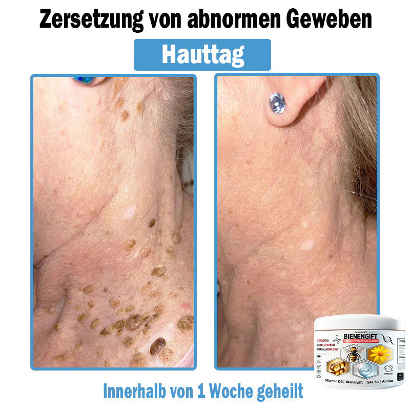 Verbesserung innerhalb von 7 Tagenโฐ๐ฟ๐ค๐ง๐ข๐ค๐ง๐ค๐ฃ๐โข ๐ต๐๐ช๐ก๐ฉ๐๐จ๐ฎ๐ข๐ฅ๐ฉ๐ค๐ข ๐ฝ๐๐๐ฃ๐๐ฃ๐๐๐๐ฉ ๐ฝ๐๐ง๐ช๐๐๐๐ช๐ฃ๐๐จ๐๐ง๐๐ข๐(๐จโโ๐๐๐ ๐๐ฆ๐ฉ๐๐จ๐ก๐ฅ๐๐ง) (๐๐ง๐ญ๐๐๐ซ๐ง๐ญ ๐๐ค๐ง๐, ๐๐๐ซ๐ณ๐๐ง, ๐๐จ๐ฌ๐๐๐๐, ๐๐ฌ๐จ๐ซ๐ข๐๐ฌ๐ข๐ฌ, ๐๐ฅ๐ญ๐๐ซ๐ฌ๐๐ฅ๐๐๐ค๐๐ง, ๐๐ค๐ณ๐๐ฆ๐ ๐ฎ๐ง๐ ๐ ๐ฅรค๐ญ๐ญ๐๐ญ ๐๐๐ก๐ง๐ฎ๐ง๐ ๐ฌ๐ฌ๐ญ๐ซ๐๐ข๐๐๐ง)