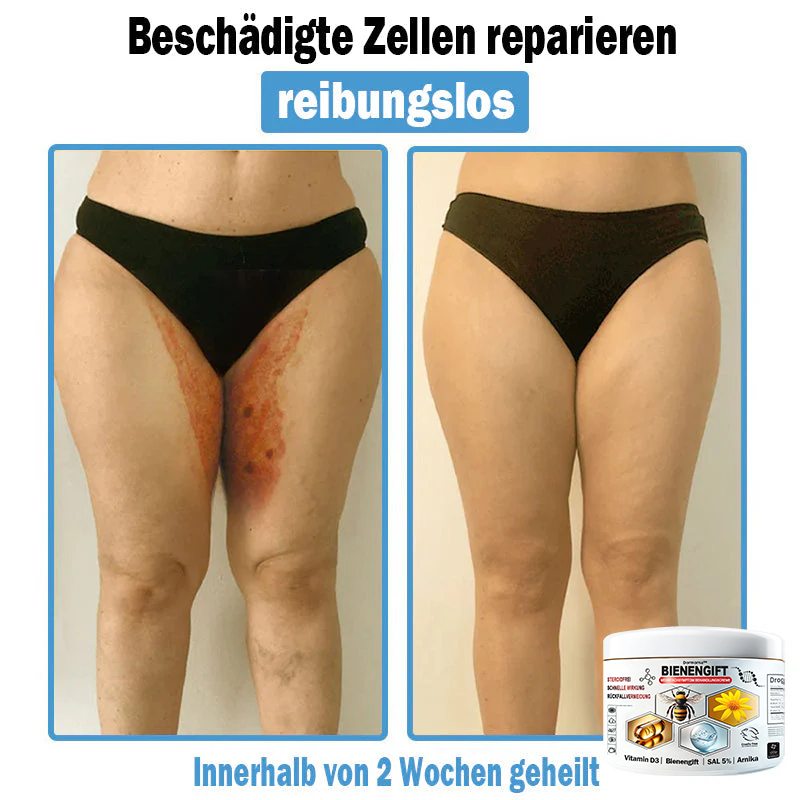 Verbesserung innerhalb von 7 Tagenโฐ๐ฟ๐ค๐ง๐ข๐ค๐ง๐ค๐ฃ๐โข ๐ต๐๐ช๐ก๐ฉ๐๐จ๐ฎ๐ข๐ฅ๐ฉ๐ค๐ข ๐ฝ๐๐๐ฃ๐๐ฃ๐๐๐๐ฉ ๐ฝ๐๐ง๐ช๐๐๐๐ช๐ฃ๐๐จ๐๐ง๐๐ข๐(๐จโโ๐๐๐ ๐๐ฆ๐ฉ๐๐จ๐ก๐ฅ๐๐ง) (๐๐ง๐ญ๐๐๐ซ๐ง๐ญ ๐๐ค๐ง๐, ๐๐๐ซ๐ณ๐๐ง, ๐๐จ๐ฌ๐๐๐๐, ๐๐ฌ๐จ๐ซ๐ข๐๐ฌ๐ข๐ฌ, ๐๐ฅ๐ญ๐๐ซ๐ฌ๐๐ฅ๐๐๐ค๐๐ง, ๐๐ค๐ณ๐๐ฆ๐ ๐ฎ๐ง๐ ๐ ๐ฅรค๐ญ๐ญ๐๐ญ ๐๐๐ก๐ง๐ฎ๐ง๐ ๐ฌ๐ฌ๐ญ๐ซ๐๐ข๐๐๐ง)