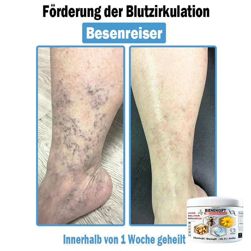 Verbesserung innerhalb von 7 Tagenโฐ๐ฟ๐ค๐ง๐ข๐ค๐ง๐ค๐ฃ๐โข ๐ต๐๐ช๐ก๐ฉ๐๐จ๐ฎ๐ข๐ฅ๐ฉ๐ค๐ข ๐ฝ๐๐๐ฃ๐๐ฃ๐๐๐๐ฉ ๐ฝ๐๐ง๐ช๐๐๐๐ช๐ฃ๐๐จ๐๐ง๐๐ข๐(๐จโโ๐๐๐ ๐๐ฆ๐ฉ๐๐จ๐ก๐ฅ๐๐ง) (๐๐ง๐ญ๐๐๐ซ๐ง๐ญ ๐๐ค๐ง๐, ๐๐๐ซ๐ณ๐๐ง, ๐๐จ๐ฌ๐๐๐๐, ๐๐ฌ๐จ๐ซ๐ข๐๐ฌ๐ข๐ฌ, ๐๐ฅ๐ญ๐๐ซ๐ฌ๐๐ฅ๐๐๐ค๐๐ง, ๐๐ค๐ณ๐๐ฆ๐ ๐ฎ๐ง๐ ๐ ๐ฅรค๐ญ๐ญ๐๐ญ ๐๐๐ก๐ง๐ฎ๐ง๐ ๐ฌ๐ฌ๐ญ๐ซ๐๐ข๐๐๐ง)