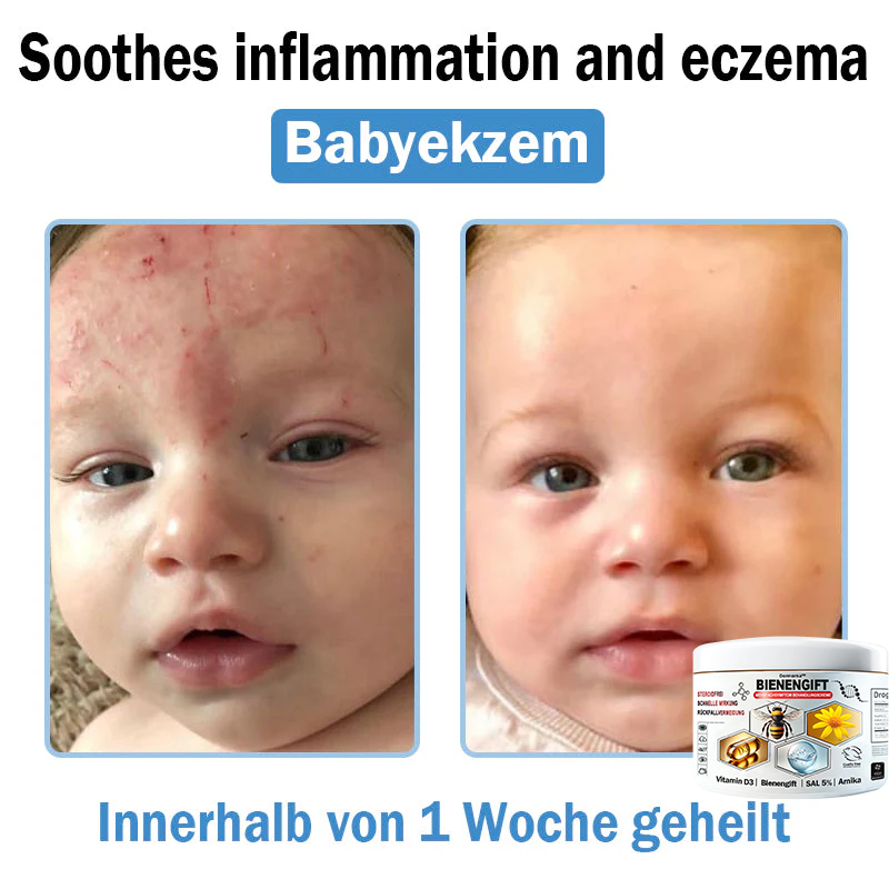 Verbesserung innerhalb von 7 Tagenโฐ๐ฟ๐ค๐ง๐ข๐ค๐ง๐ค๐ฃ๐โข ๐ต๐๐ช๐ก๐ฉ๐๐จ๐ฎ๐ข๐ฅ๐ฉ๐ค๐ข ๐ฝ๐๐๐ฃ๐๐ฃ๐๐๐๐ฉ ๐ฝ๐๐ง๐ช๐๐๐๐ช๐ฃ๐๐จ๐๐ง๐๐ข๐(๐จโโ๐๐๐ ๐๐ฆ๐ฉ๐๐จ๐ก๐ฅ๐๐ง) (๐๐ง๐ญ๐๐๐ซ๐ง๐ญ ๐๐ค๐ง๐, ๐๐๐ซ๐ณ๐๐ง, ๐๐จ๐ฌ๐๐๐๐, ๐๐ฌ๐จ๐ซ๐ข๐๐ฌ๐ข๐ฌ, ๐๐ฅ๐ญ๐๐ซ๐ฌ๐๐ฅ๐๐๐ค๐๐ง, ๐๐ค๐ณ๐๐ฆ๐ ๐ฎ๐ง๐ ๐ ๐ฅรค๐ญ๐ญ๐๐ญ ๐๐๐ก๐ง๐ฎ๐ง๐ ๐ฌ๐ฌ๐ญ๐ซ๐๐ข๐๐๐ง)