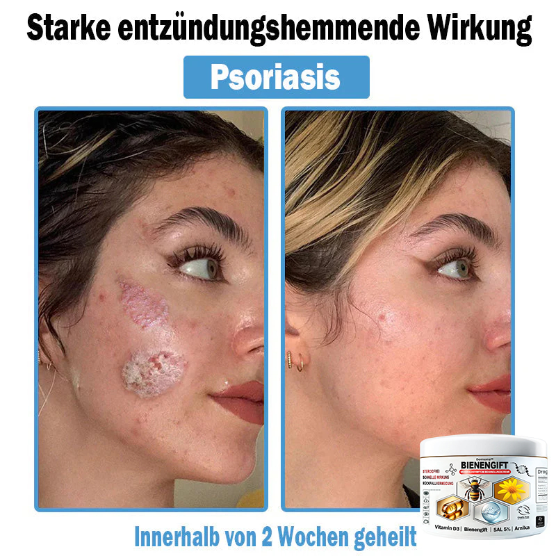 Verbesserung innerhalb von 7 Tagenโฐ๐ฟ๐ค๐ง๐ข๐ค๐ง๐ค๐ฃ๐โข ๐ต๐๐ช๐ก๐ฉ๐๐จ๐ฎ๐ข๐ฅ๐ฉ๐ค๐ข ๐ฝ๐๐๐ฃ๐๐ฃ๐๐๐๐ฉ ๐ฝ๐๐ง๐ช๐๐๐๐ช๐ฃ๐๐จ๐๐ง๐๐ข๐(๐จโโ๐๐๐ ๐๐ฆ๐ฉ๐๐จ๐ก๐ฅ๐๐ง) (๐๐ง๐ญ๐๐๐ซ๐ง๐ญ ๐๐ค๐ง๐, ๐๐๐ซ๐ณ๐๐ง, ๐๐จ๐ฌ๐๐๐๐, ๐๐ฌ๐จ๐ซ๐ข๐๐ฌ๐ข๐ฌ, ๐๐ฅ๐ญ๐๐ซ๐ฌ๐๐ฅ๐๐๐ค๐๐ง, ๐๐ค๐ณ๐๐ฆ๐ ๐ฎ๐ง๐ ๐ ๐ฅรค๐ญ๐ญ๐๐ญ ๐๐๐ก๐ง๐ฎ๐ง๐ ๐ฌ๐ฌ๐ญ๐ซ๐๐ข๐๐๐ง)