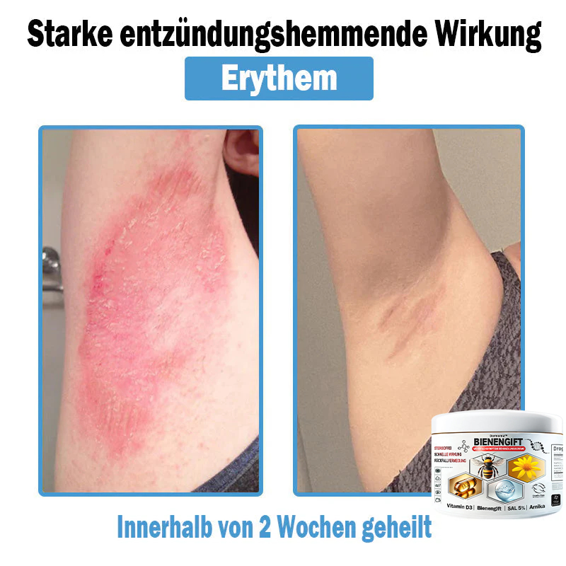 Verbesserung innerhalb von 7 Tagenโฐ๐ฟ๐ค๐ง๐ข๐ค๐ง๐ค๐ฃ๐โข ๐ต๐๐ช๐ก๐ฉ๐๐จ๐ฎ๐ข๐ฅ๐ฉ๐ค๐ข ๐ฝ๐๐๐ฃ๐๐ฃ๐๐๐๐ฉ ๐ฝ๐๐ง๐ช๐๐๐๐ช๐ฃ๐๐จ๐๐ง๐๐ข๐(๐จโโ๐๐๐ ๐๐ฆ๐ฉ๐๐จ๐ก๐ฅ๐๐ง) (๐๐ง๐ญ๐๐๐ซ๐ง๐ญ ๐๐ค๐ง๐, ๐๐๐ซ๐ณ๐๐ง, ๐๐จ๐ฌ๐๐๐๐, ๐๐ฌ๐จ๐ซ๐ข๐๐ฌ๐ข๐ฌ, ๐๐ฅ๐ญ๐๐ซ๐ฌ๐๐ฅ๐๐๐ค๐๐ง, ๐๐ค๐ณ๐๐ฆ๐ ๐ฎ๐ง๐ ๐ ๐ฅรค๐ญ๐ญ๐๐ญ ๐๐๐ก๐ง๐ฎ๐ง๐ ๐ฌ๐ฌ๐ญ๐ซ๐๐ข๐๐๐ง)