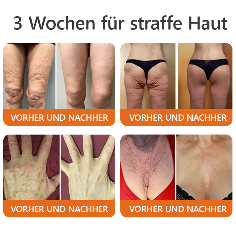 Made in Germany, verschickt aus Deutschlandโจ๐ณ๐ฌ๐ญ๐ผ๐ตโข ๐ฌ๐๐๐๐๐๐๐๐๐ ๐๐๐๐๐๐๐๐๐
๐ ๐จ๐๐๐-๐ญ๐๐๐๐๐-๐ช๐๐๐๐-LETZTER TAG 70% RABATT๐๐