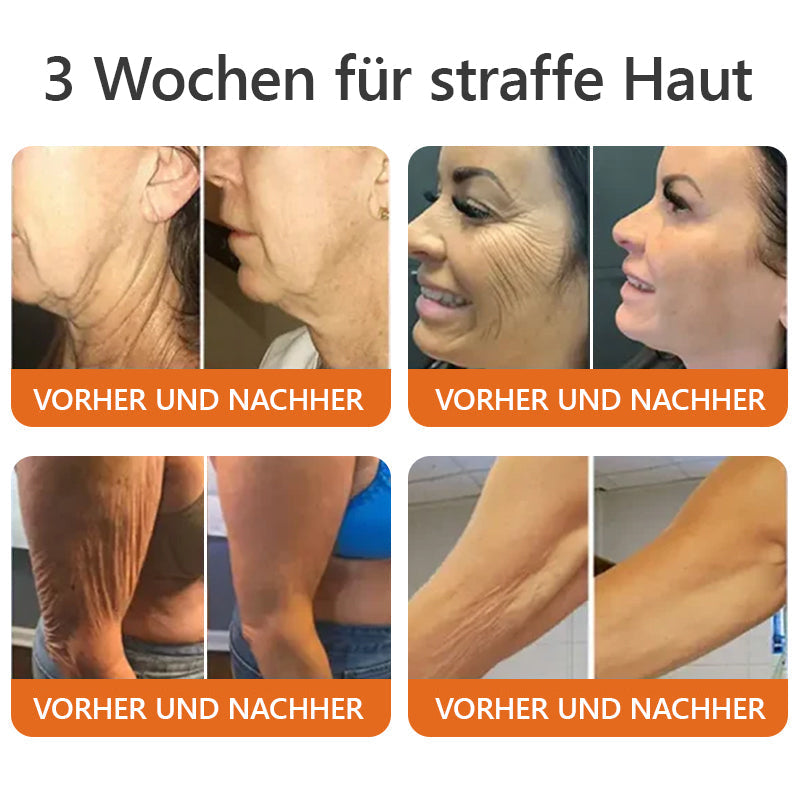 Made in Germany, verschickt aus Deutschlandโจ๐ณ๐ฌ๐ญ๐ผ๐ตโข ๐ฌ๐๐๐๐๐๐๐๐๐ ๐๐๐๐๐๐๐๐๐
๐ ๐จ๐๐๐-๐ญ๐๐๐๐๐-๐ช๐๐๐๐-LETZTER TAG 70% RABATT๐๐