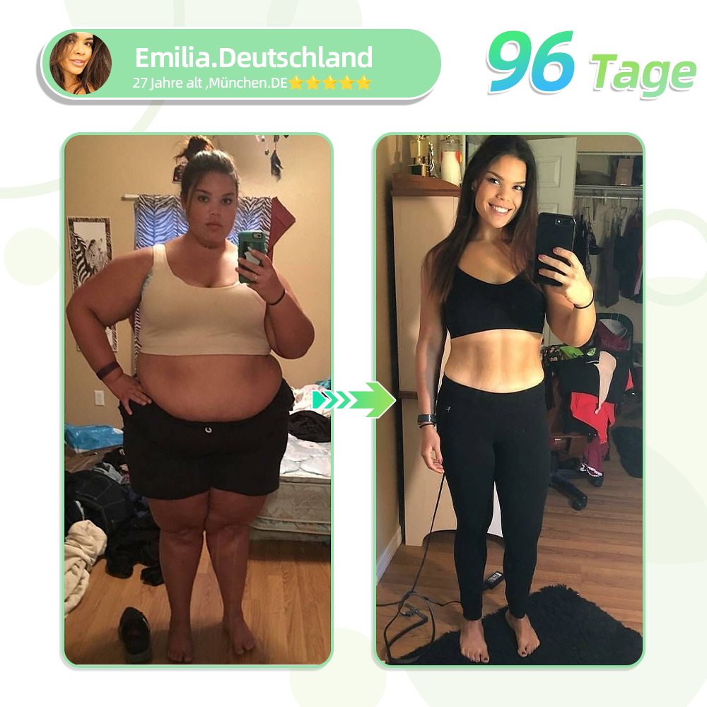 👨⚕️𝐋𝐞𝐫𝐜𝐞𝐚®SMGT-GLP-1 Nano-Mikronadel-Pflaster(Schmerzfrei, lang anhaltend, gegen Diabetes, Fettleibigkeit und Herz-Kreislauf-Erkrankungen)