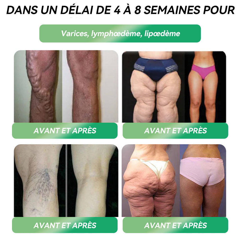 𝐋𝐄𝑹𝑪𝐄𝐀® Ampoules Orales Équilibre Métabolique GLP-1👨⚕️ Obésité, maladies cardiovasculaires, diabète, apnée du sommeil, troubles articulaires et autres affections💎