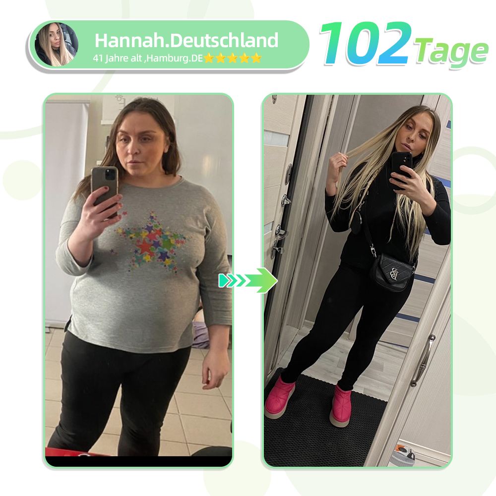 👨⚕️𝐋𝐞𝐫𝐜𝐞𝐚®SMGT-GLP-1 Nano-Mikronadel-Pflaster(Schmerzfrei, lang anhaltend, gegen Diabetes, Fettleibigkeit und Herz-Kreislauf-Erkrankungen)