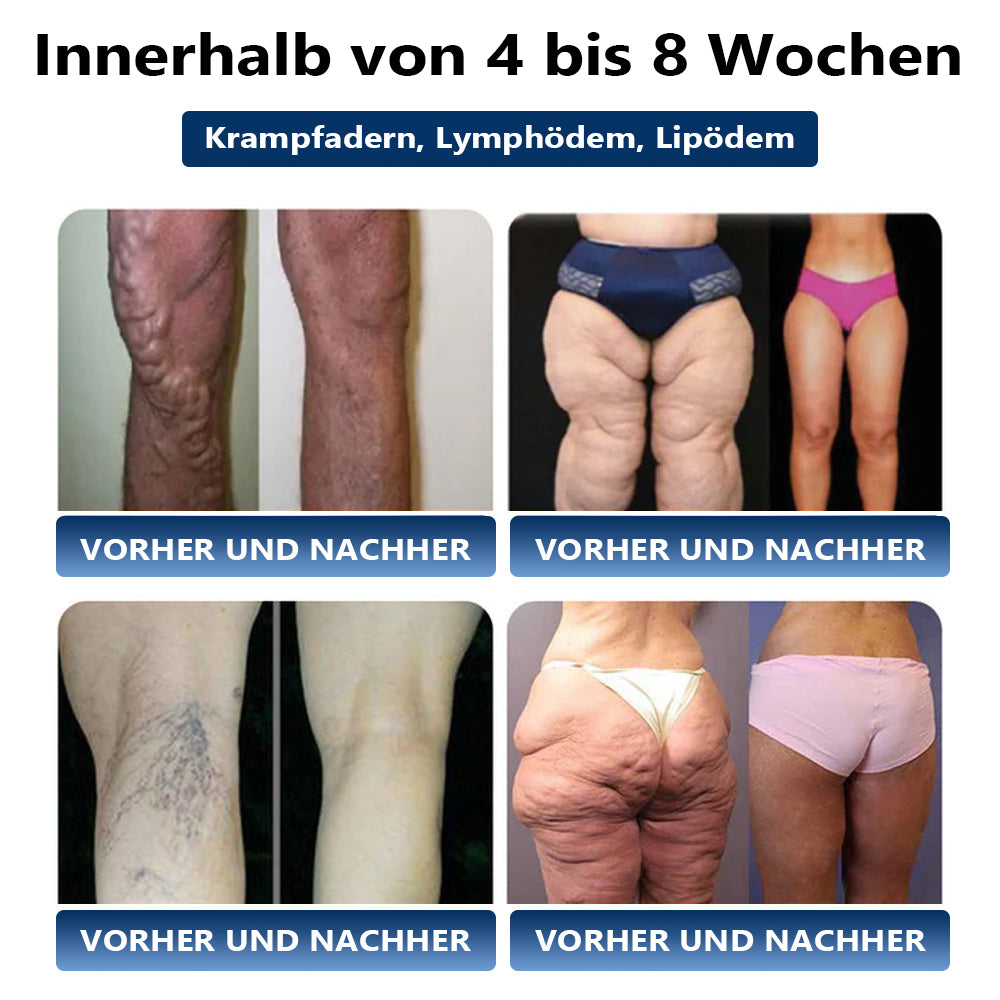 ⚡𝐏𝐊𝐍𝐄𝐖® Ultraschall- und Ferninfrarot-Therapiegerät👨⚕️ Original 2-in-1-Therapie | Beseitigt hartnäckiges Fett und fördert den Stoffwechsel