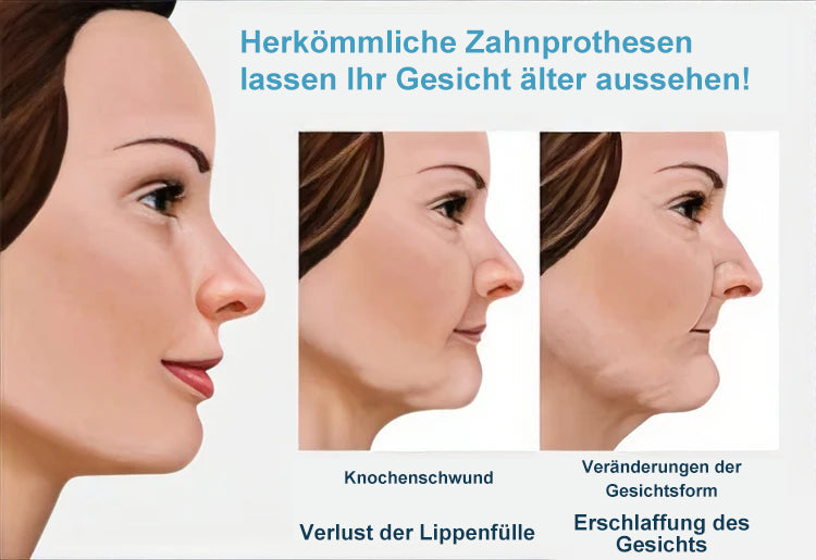 𝐇𝐄𝐀𝐓𝐖𝐎𝐋𝐅®🦷Fortgeschrittenes maßgeschneidertes Vollprothesenset🦷 zertifiziert und entwickelt in Zusammenarbeit mit der Deutschen Gesellschaft für Zahn-Mund- und Kieferheilkunde (DGZMK)