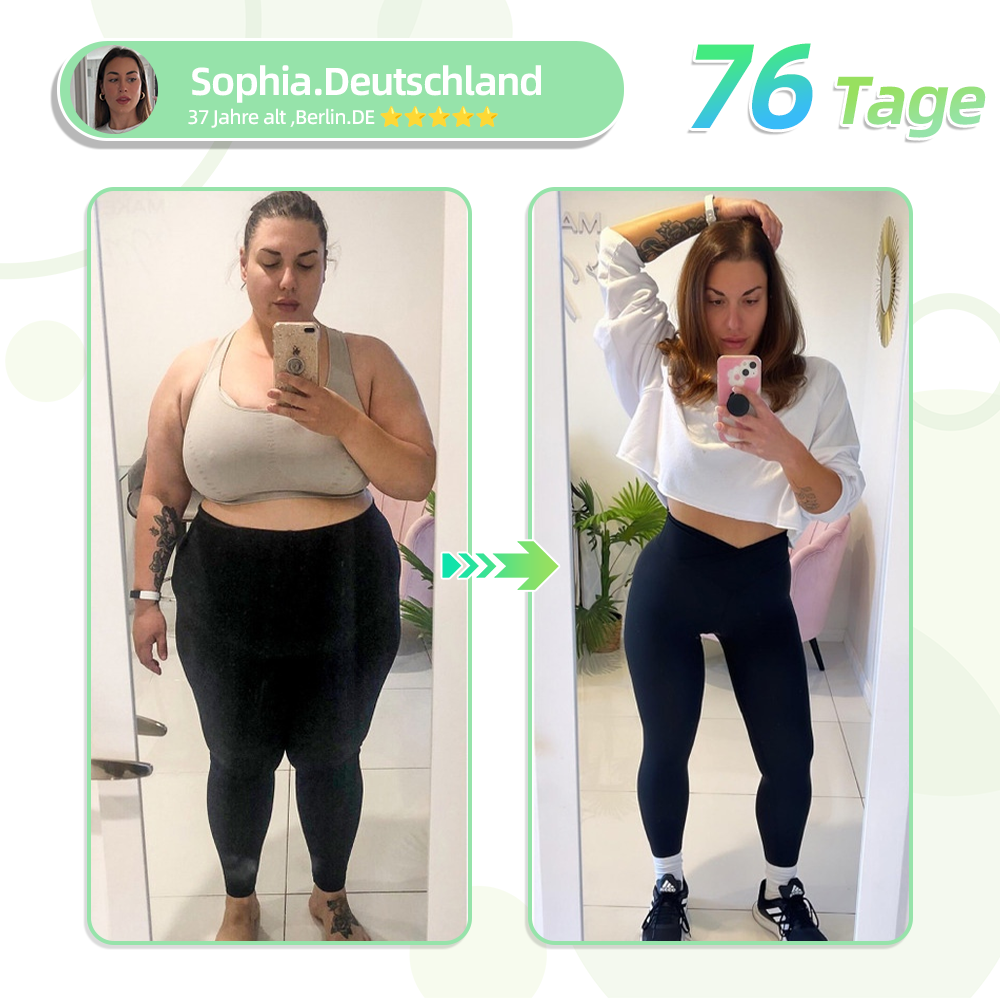 👨⚕️𝐋𝐞𝐫𝐜𝐞𝐚®SMGT-GLP-1 Nano-Mikronadel-Pflaster(Schmerzfrei, lang anhaltend, gegen Diabetes, Fettleibigkeit und Herz-Kreislauf-Erkrankungen)