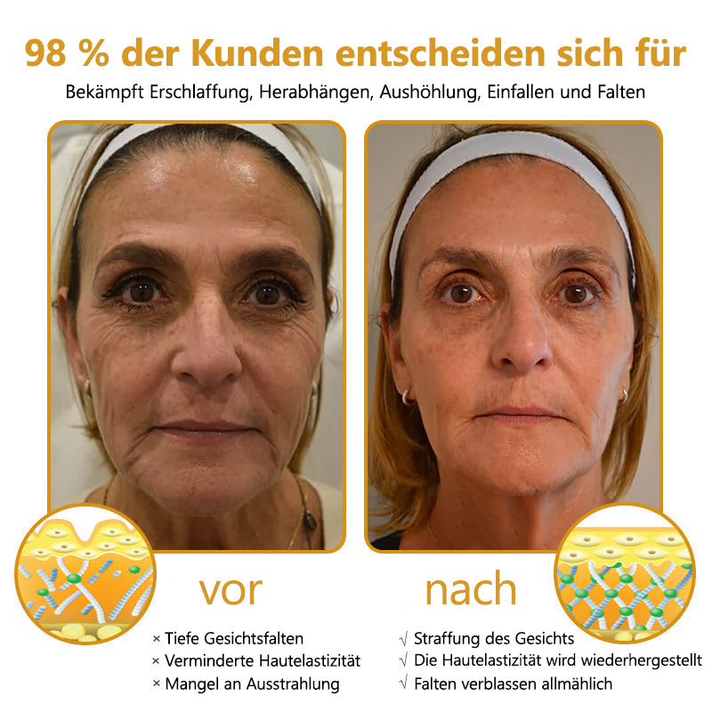 Fubsta® Advanced Straffende & Faltenreduzierende Creme: Botox Bienengift-Therapie✅