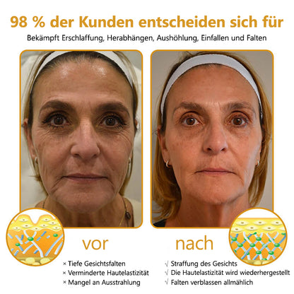 Fubsta® Advanced Straffende & Faltenreduzierende Creme: Botox Bienengift-Therapie✅