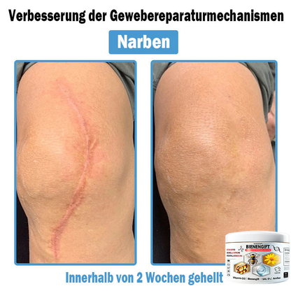 Verbesserung innerhalb von 7 Tagen⏰𝘿𝙤𝙧𝙢𝙤𝙧𝙤𝙣𝙖™ 🌵𝙈𝙪𝙡𝙩𝙞𝙨𝙮𝙢𝙥𝙩𝙤𝙢 𝘽𝙞𝙚𝙣𝙚𝙣𝙜𝙞𝙛𝙩 𝘽𝙚𝙧𝙪𝙝𝙞𝙜𝙪𝙣𝙜𝙨𝙘𝙧𝙚𝙢𝙚(👨‍⚕𝐃𝐃𝐆 𝐄𝐦𝐩𝐟𝐨𝐡𝐥𝐞𝐧) (𝐄𝐧𝐭𝐟𝐞𝐫𝐧𝐭 𝐀𝐤𝐧𝐞, 𝐖𝐚𝐫𝐳𝐞𝐧, 𝐑𝐨𝐬𝐚𝐜𝐞𝐚, 𝐏𝐬𝐨𝐫𝐢𝐚𝐬𝐢𝐬, 𝐀𝐥𝐭𝐞𝐫𝐬𝐟𝐥𝐞𝐜𝐤𝐞𝐧, 𝐄𝐤𝐳𝐞𝐦𝐞 𝐮𝐧𝐝 𝐠𝐥ä𝐭𝐭𝐞𝐭 𝐃𝐞𝐡𝐧𝐮𝐧𝐠𝐬𝐬𝐭𝐫𝐞𝐢𝐟𝐞𝐧)