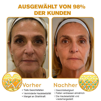 Letzter Tag der Aktion: 70 % Rabatt - ✨Lenaro™ Botox Bienenvenom Faltenentfernungscreme