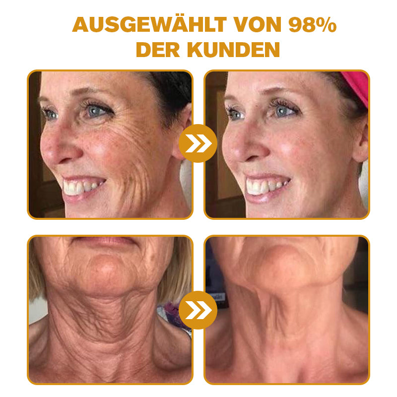 Letzter Tag der Aktion: 70 % Rabatt - ✨Lenaro™ Botox Bienenvenom Faltenentfernungscreme