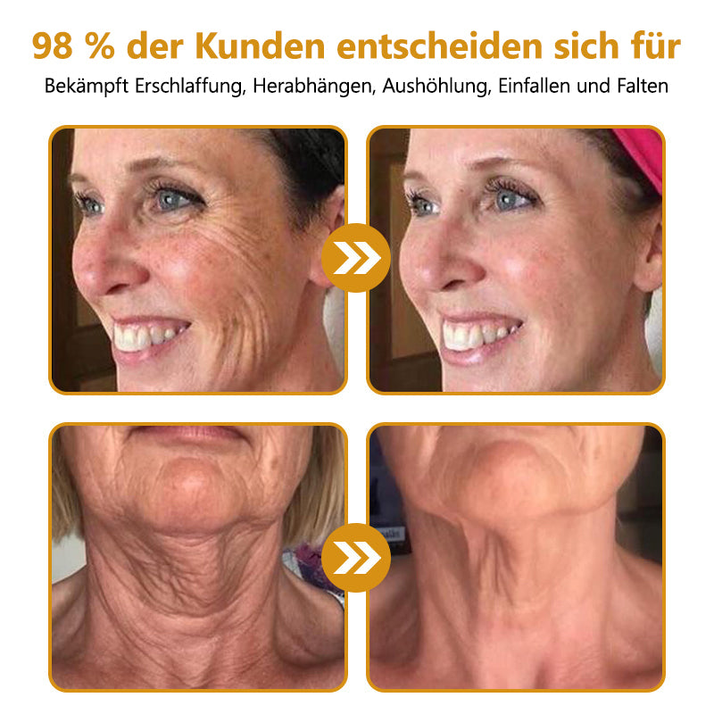 Fubsta® Advanced Straffende & Faltenreduzierende Creme: Botox Bienengift-Therapie✅