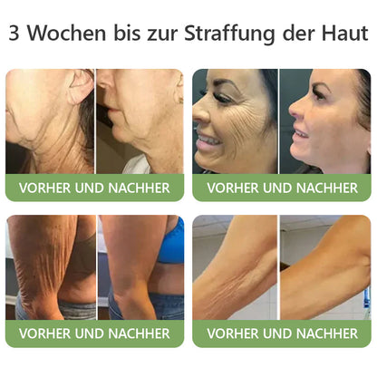Hergestellt und versendet aus Deutschland 🔥 Lenaro® Bienenvenom Anti-Falten-Creme - 🌿 LETZTER TAG 80% RABATT