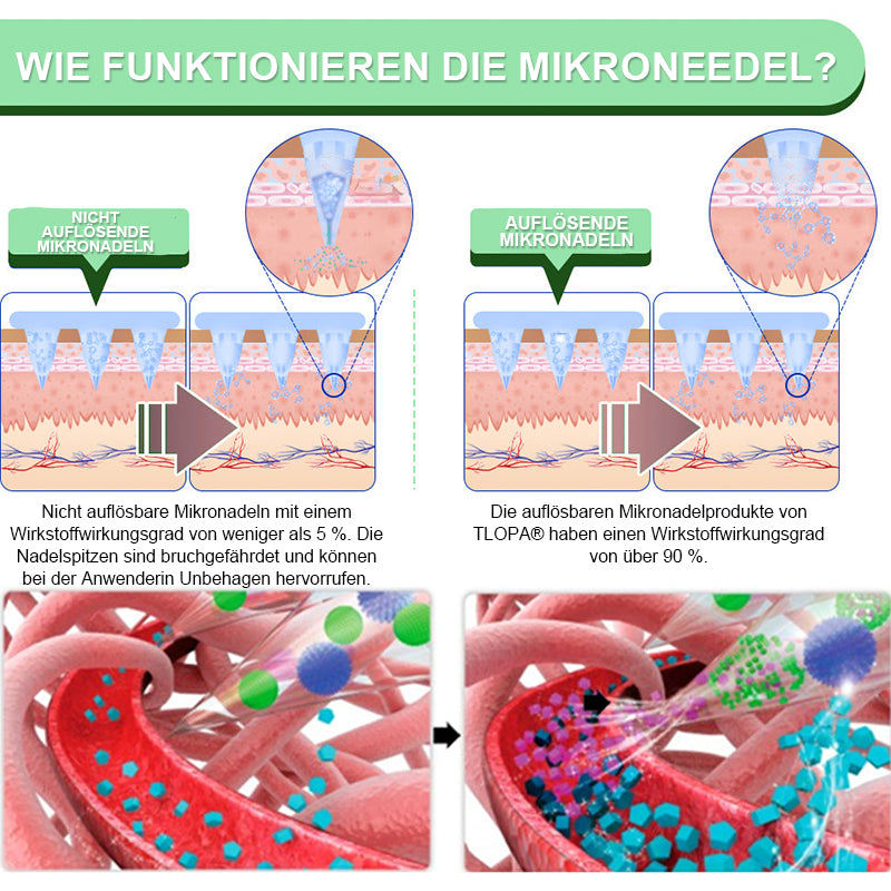 【Letzter Tag der Aktion –60 %】TLOPA® Schlankheits- & Gesundheits-Pflaster mit NANO-MIKRONADELN Tirzepatid-NIDDK 💕（Schmerzfrei, 24h-Wirkstofffreisetzung | Schnell 9 kg abnehmen | 90 % Zuckerreduktion）