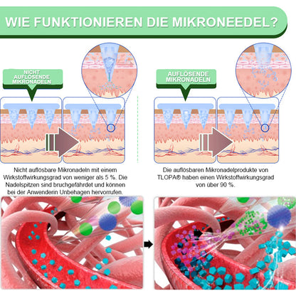 【Letzter Tag der Aktion –60 %】TLOPA® Schlankheits- & Gesundheits-Pflaster mit NANO-MIKRONADELN Tirzepatid-NIDDK 💕（Schmerzfrei, 24h-Wirkstofffreisetzung | Schnell 9 kg abnehmen | 90 % Zuckerreduktion）