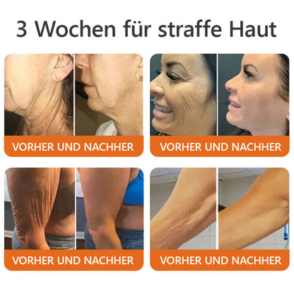 Made in Germany, verschickt aus Deutschland✨𝑳𝑬𝑭𝑼𝑵™ 𝑬𝒓𝒘𝒆𝒊𝒕𝒆𝒓𝒕𝒆 𝒔𝒕𝒓𝒂𝒇𝒇𝒆𝒏𝒅𝒆 𝑨𝒏𝒕𝒊-𝑭𝒂𝒍𝒕𝒆𝒏-𝑪𝒓𝒆𝒎𝒆-LETZTER TAG 70% RABATT👑👑