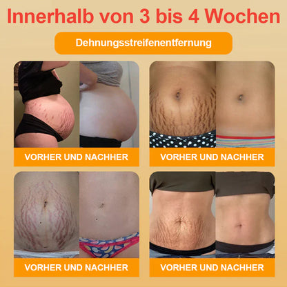 🎉Kaufen Sie eine zweite Bestellung mit 50 % Rabatt🎉