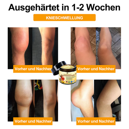 Aeehfeng™ 🎁Bienengift-Schmerzlinderungs Knochenheilungs Creme 👨‍⚕️Deutsch (BfArM) genehmigt(Reduzierung von Gelenkschwellungen, Schmerzen, Steifheit, Rötungen, Wärme, Muskelkater und Gelenkmüdigkeit)