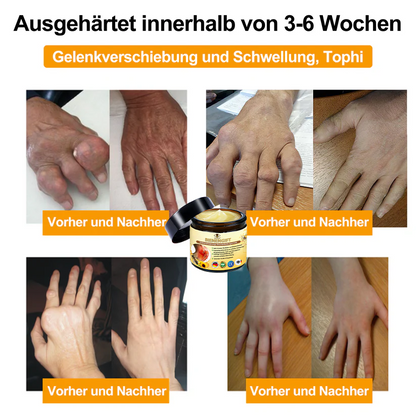 Aeehfeng™ 🎁Bienengift-Schmerzlinderungs Knochenheilungs Creme 👨‍⚕️Deutsch (BfArM) genehmigt(Reduzierung von Gelenkschwellungen, Schmerzen, Steifheit, Rötungen, Wärme, Muskelkater und Gelenkmüdigkeit)